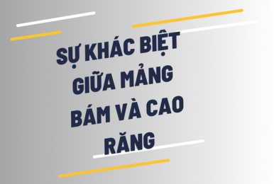 Mảng bám trên răng và cao răng khác nhau như thế nào?