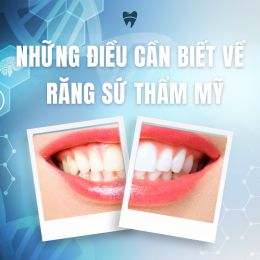 Răng sứ thẩm mỹ là gì