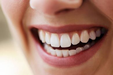 Nướu răng là gì? Cách chăm sóc nướu răng