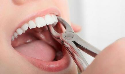 NHỔ RĂNG TRỒNG LẠI  CÓ ĐAU KHÔNG?