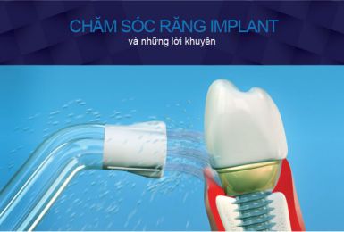 Loại bỏ vi khuẩn - Đẩy lùi bệnh răng miệng